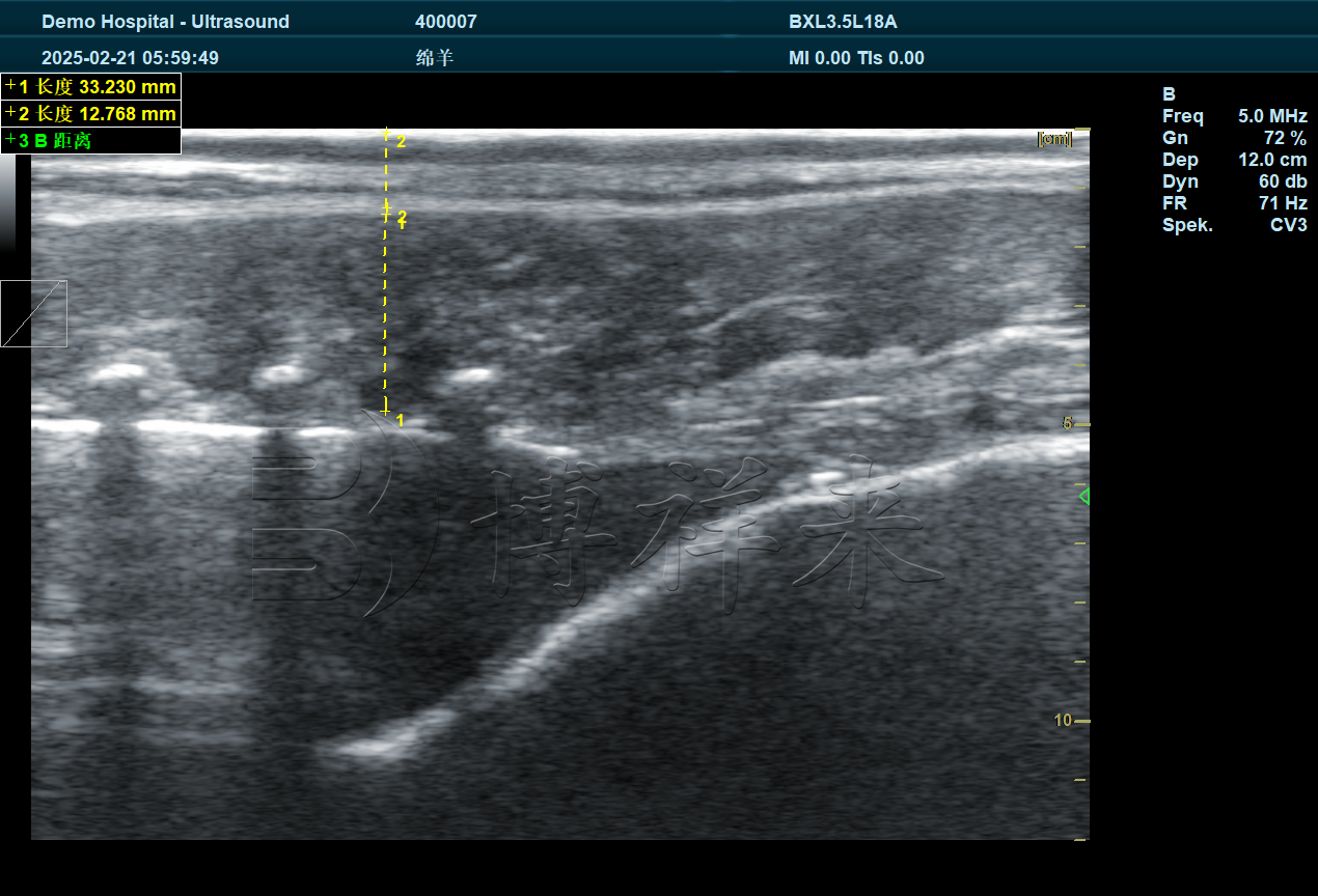 2025.02 赛诺羊场DZ20羊背膘眼肌 (4).png