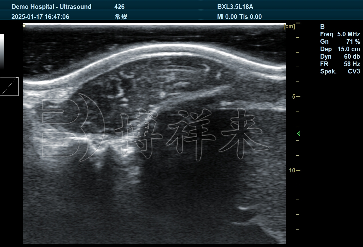 牛背膘眼肌视频-DB20 (5).jpg