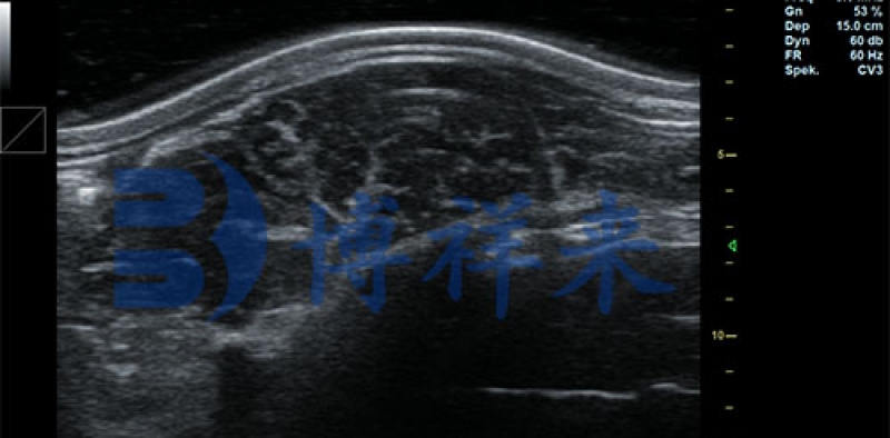 猪背膘仪维护不当会导致数据偏差？日常保养有哪些关键点？