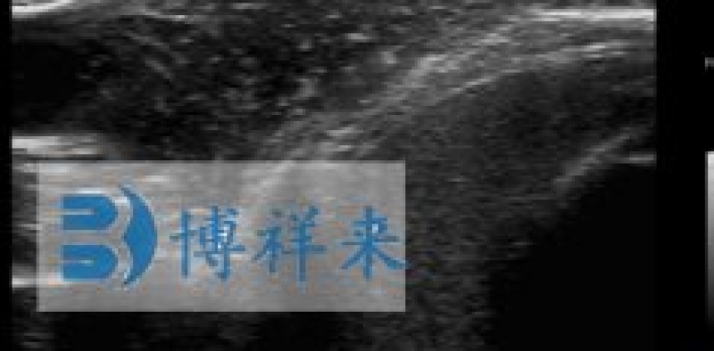 B超检测羊背膘眼肌面积的意义