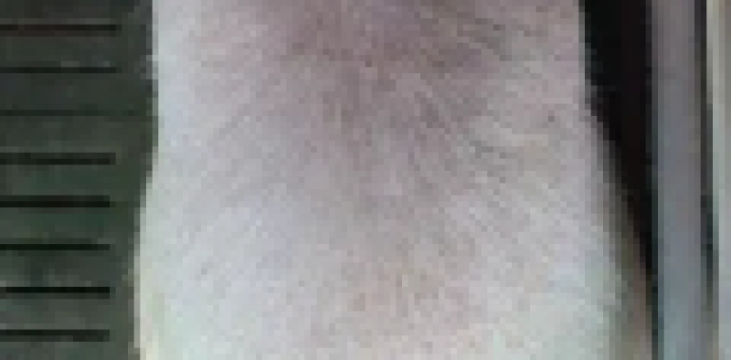 背膘眼肌测定仪